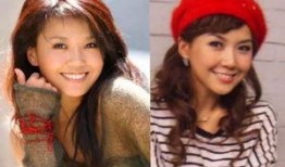 港星整容综艺爆料视频,明星整形内幕曝光